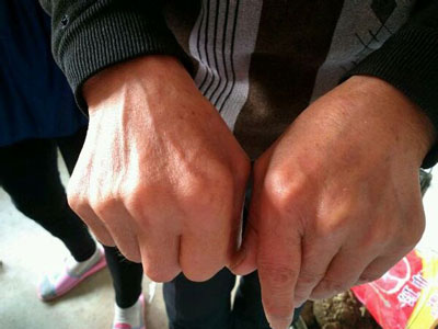 ��������ָ�ؽڱ��Σ��輰ʱ����