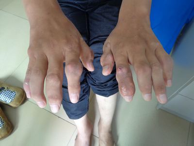 ���ߵ�һ������ǰ���ֲ������Զദʹ��ʯ