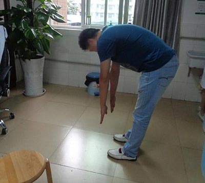 强直错误治疗病情加重,AS-净骨疗法助他重拾健康.jpg